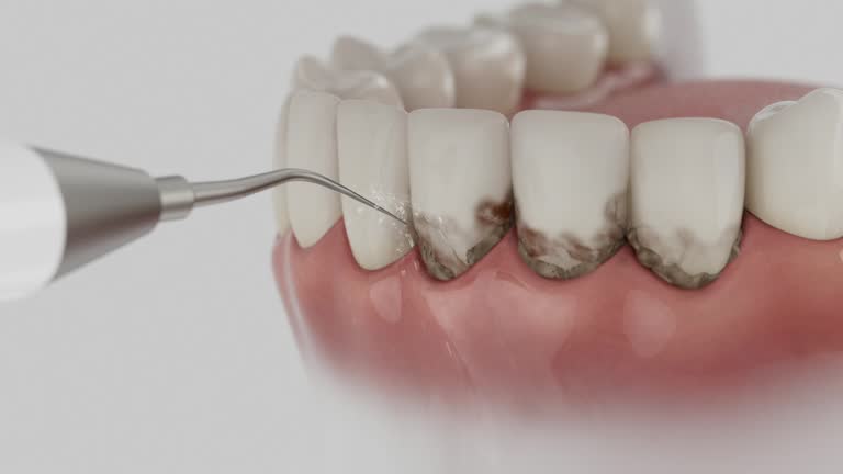 Trusted Root Canal Treatment service in Richmond, CA - Dentist Open Now